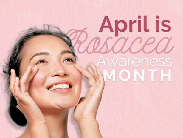 Rosacea Awareness Month: Unveiling Customized Care at our MedSpa